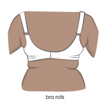 Armpit Fat &amp; "Bra Roll": Your Solutions at The Langdon 